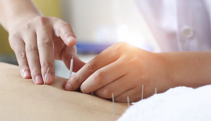 نحوه تاثیر طب سوزنی برای افزایش قد در سنین مختلف