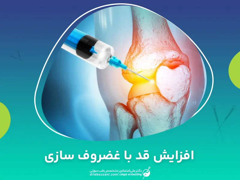 افزایش قد با غضروف سازی چگونه است؟
