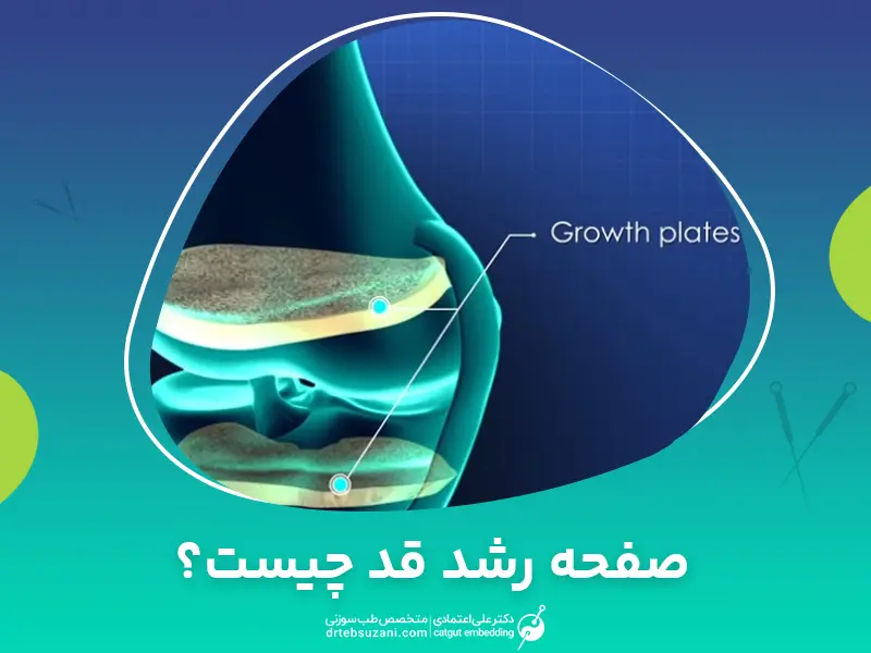 صفحه رشد قد چیست و چه عواملی روی آن تاثیر می گذارند؟